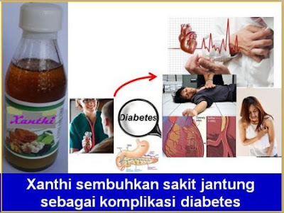 KATA SIAPA KAULA MUDA BEBAS DARI PENYAKIT JANTUNG?