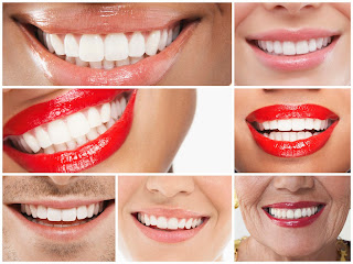 miami beach cosmetic dentist