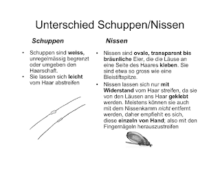   nissen oder schuppen unterschied, nissen bilder, schuppen die aussehen wie nissen, tote nissen erkennen, nissen ohne läuse, läuse schuppen trockene kopfhaut, nach läusebehandlung schuppen, jucken nissen, nissen blonde haare