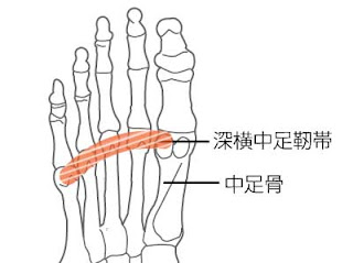 深横中足靭帯を表すイラスト。詳細は後述。