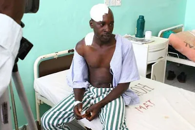 A Man cut on his face in Kilifi. PHOTO | BANA