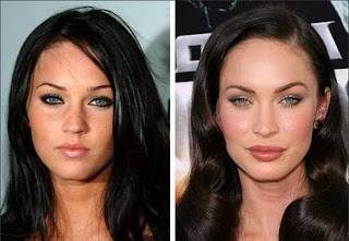 Plastic Surgery