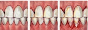 http://www.dentalperiodent.com/periodoncia-sevilla/