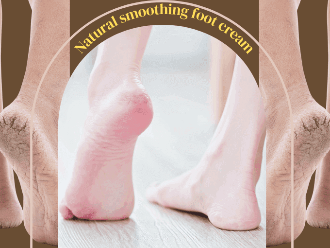 Feet | Feet cracks | How to heal cracked feet overnight