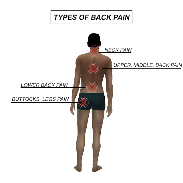 Types of Back Problems
