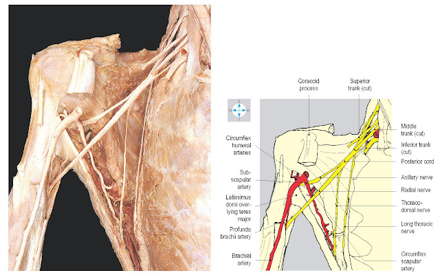 Some posterior branches of the brachial plexus seen after removal of the more anterior parts of the plexus. Biceps brachii and coracobrachialis have been excised.