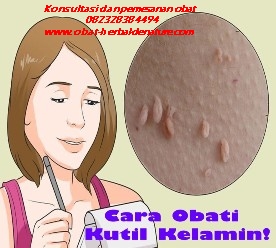 obat kutil kelamin,tanda kutil kelamin,gejala kutil kelamin,ciri ciri kutil kelamin,muncul kutil di sekitar kelamin,obat kutil tanpa operasi,cara menghilagkan kutil kelamin tanpa operasi