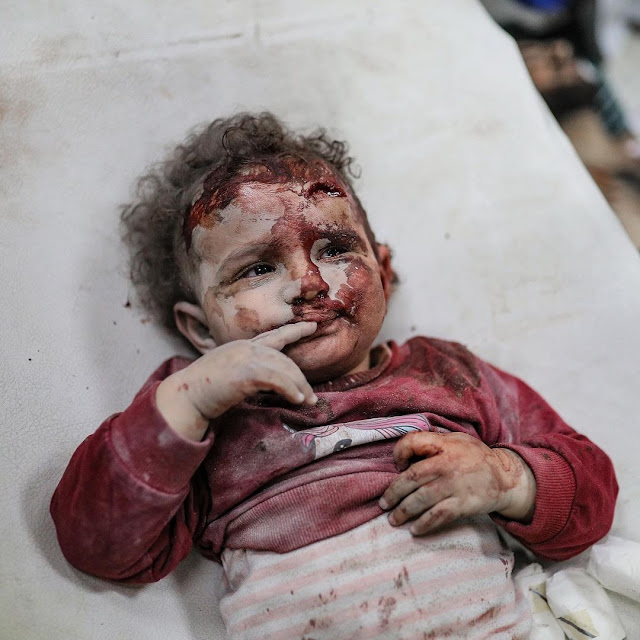 A baby survived an Israeli shelling in Gaza by Belal Khaled