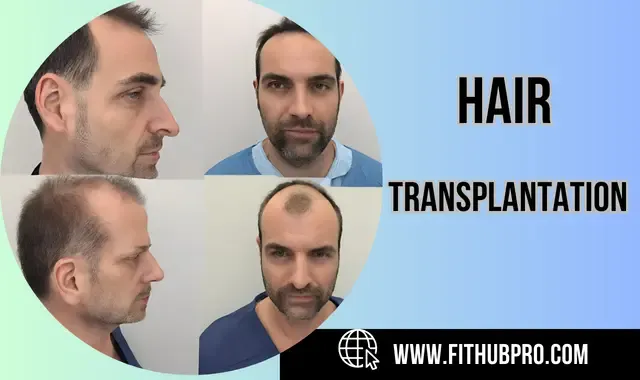 Hair Transplantation: Rediscovering Confidence and Locks Hair Transplantation: Rediscovering Confidence and Locks