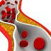 Cholesterol’s and learning about Trigylcerides