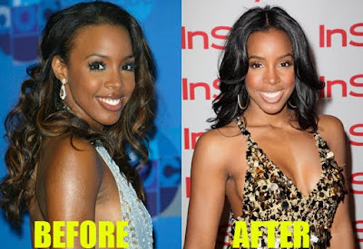 Kelly Rowland's About Her Augmentation1