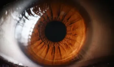 Symptoms Of Dislocated Lens After Cataract Surgery