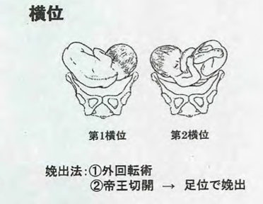 画像をダウンロード 赤ち��ん 横位 胎動 358888-赤ちゃ��� 横位 胎動