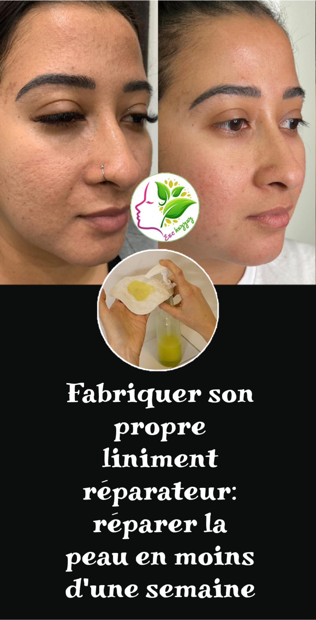 Fabriquer liniment réparateur réparer la peau