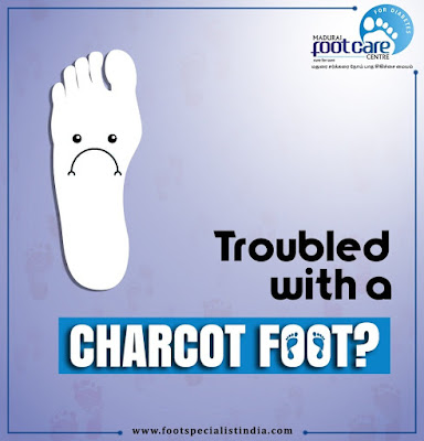 Charcot Foot