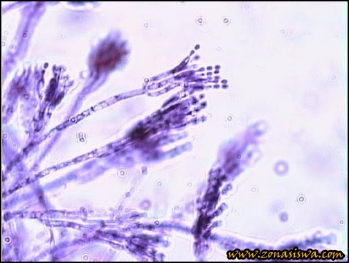  Klasifikasi Jamur  Zygomycota Ascomycota Basidiomycota 