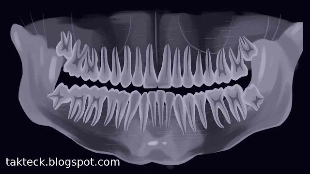 Digital Dentistry and Personalized Care by Tend Dental: A Guide to Dental Disorders and Treatment Options