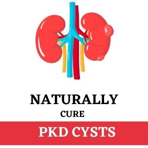 What is The Nature of PKD Cysts?