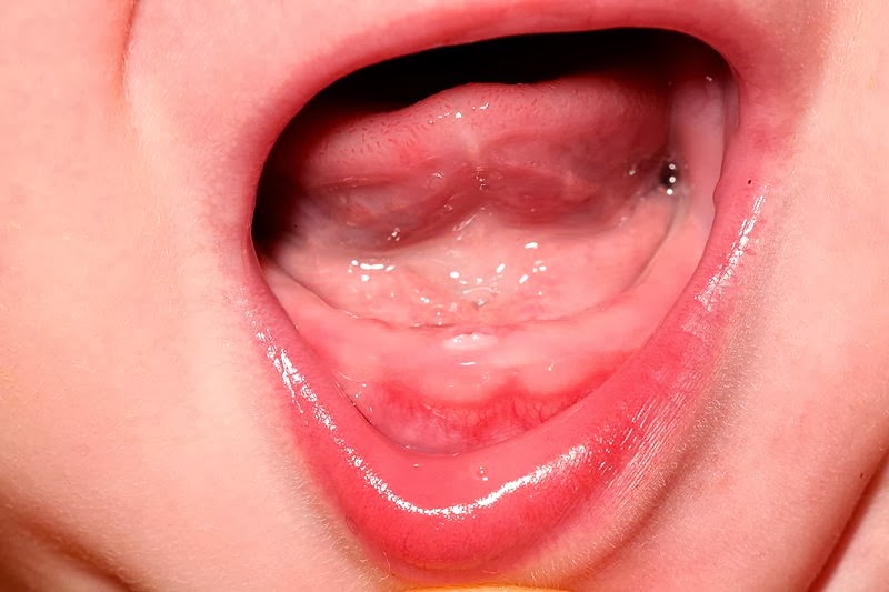 the primary lower central incisor emerging from the gum