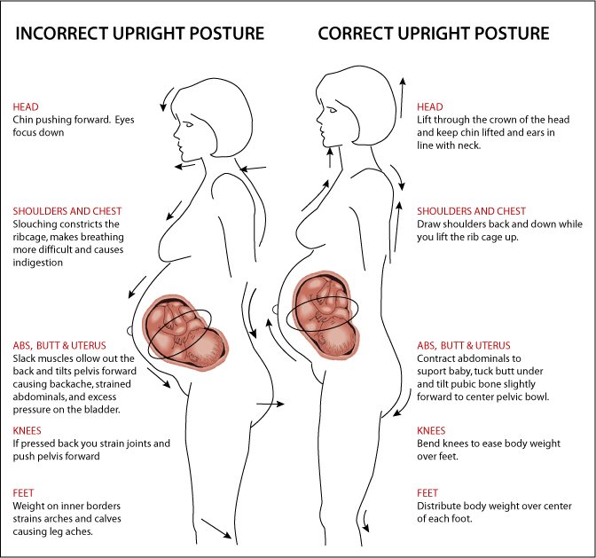 Bambie Bee: Tips On How To Make Your Baby Move : Treatment Of An ...