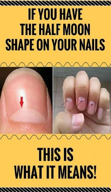 The Half Moon Shaped White Area At The Bed Of A Fingernail Can Tell A Lot About Your Health