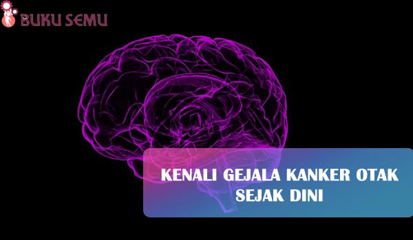 Kenali Gejala Kanker Otak Sejak Dini, bukusemu