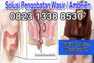 https://sediaobatwasir.blogspot.com/2019/07/nama-merk-obat-wasir-paling-ampuh.html