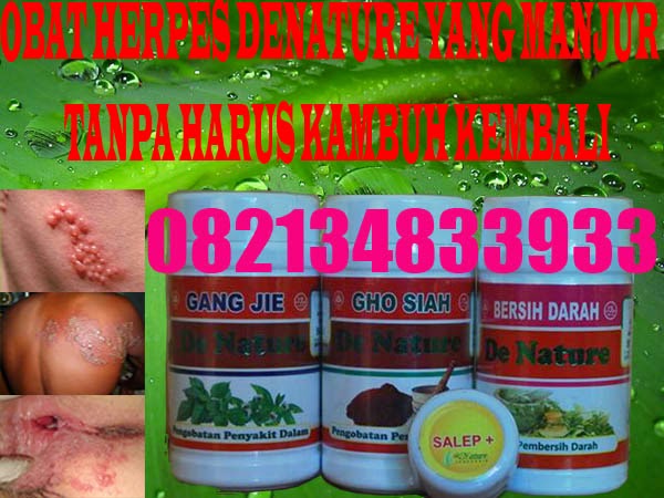 obat herpes