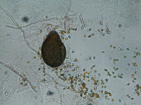 A microscope photo of a egg-shaped brown fruiting body of a fungus with round spores around it.