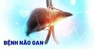 Bệnh não gan có chữa được không? Cách phòng ngừa và xử trí