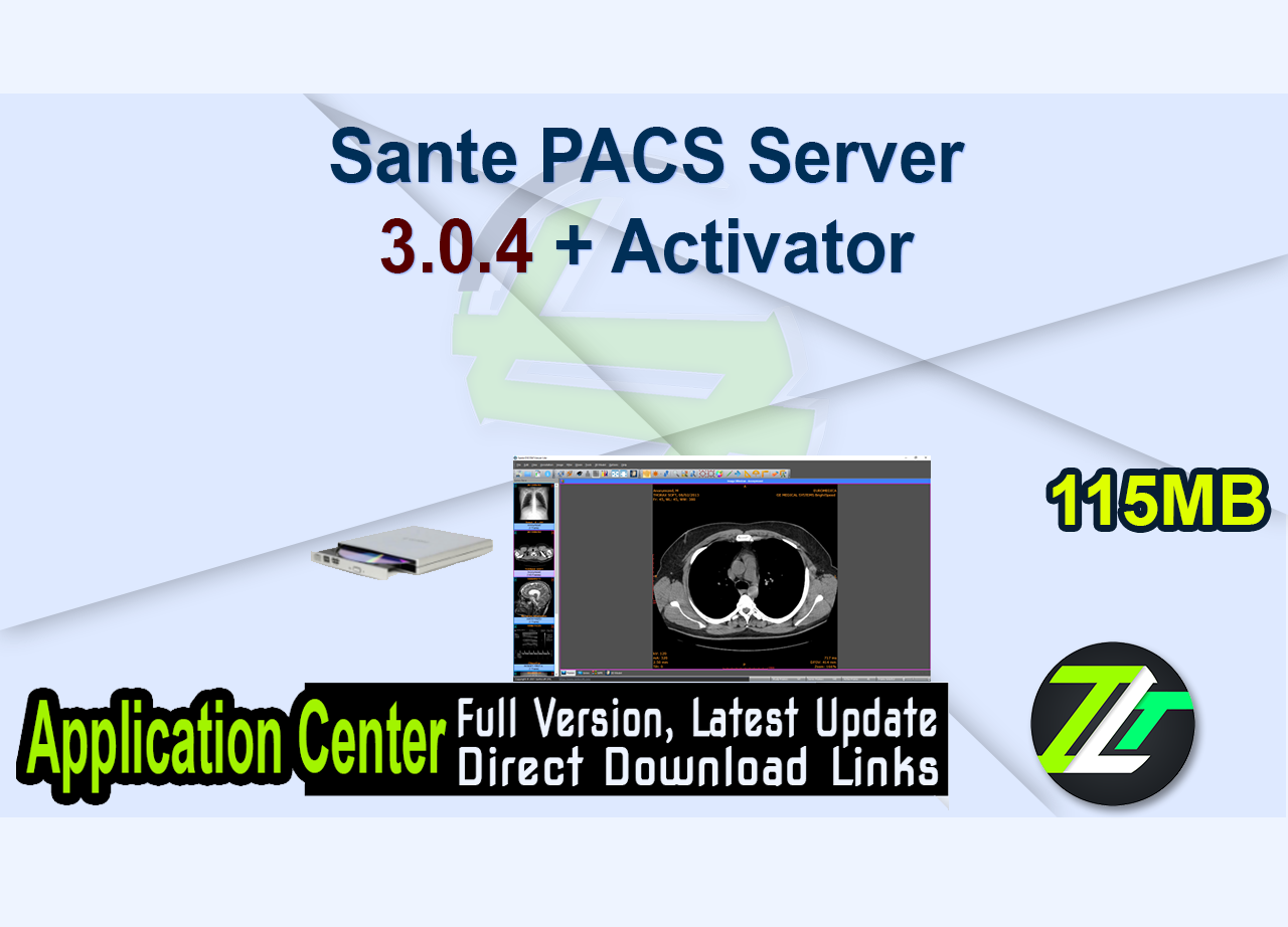Sante PACS Server 3.0.4 + Activator