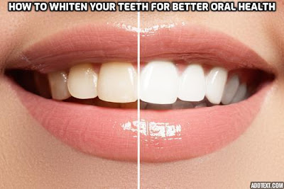A radiant smile can boost your confidence, and teeth whitening is a popular cosmetic dental procedure that can help achieve just that. How to whiten your teeth for better oral health.
