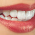 Răng sứ Cercon có gì đặc biệt?