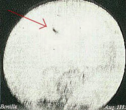 Edmonton Alberta Ufos In A V Formation