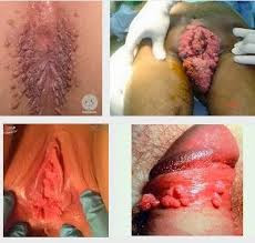 Obat Jengger Ayam Terbaik