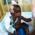 SO SAD: Housewife Breaks Leg And Arm Of 5-Year Old Step Son (Graphic Photo)