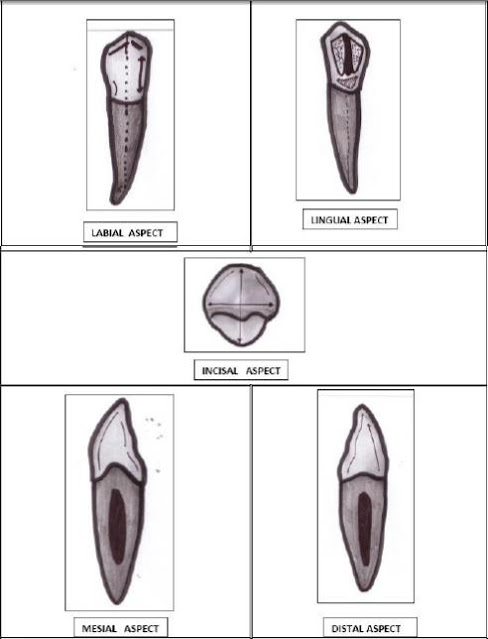 Permanent mandibular canines l tooth crown & root morphology revision for dental students