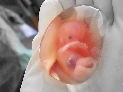 embryos at 5 weeks. Human Fetus at 10 Weeks