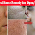 How to Fill Open Pores on Face Permanently in 3 Days  Get Smooth & Fairer skin in 3 days