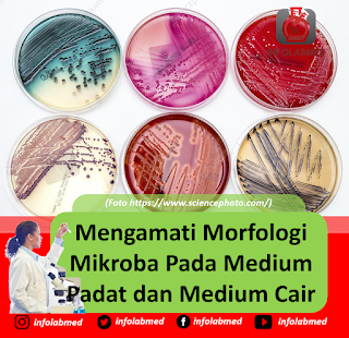 Mengamati Morfologi Mikroba Pada Medium Padat dan Medium Cair