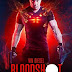 Bloodshot (2020) Hindi Dubbed Download 