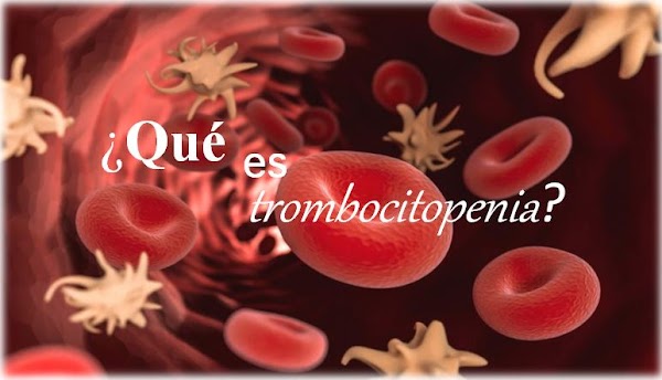 ¿Qué es la trombocitopenia inmune?