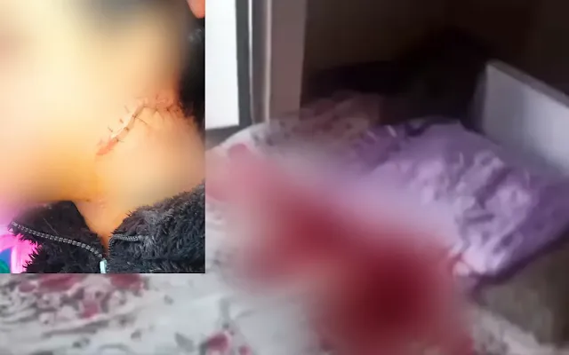 Young Woman Stabbed in Siaha, Narrowly Survives; Police Investigation Underway