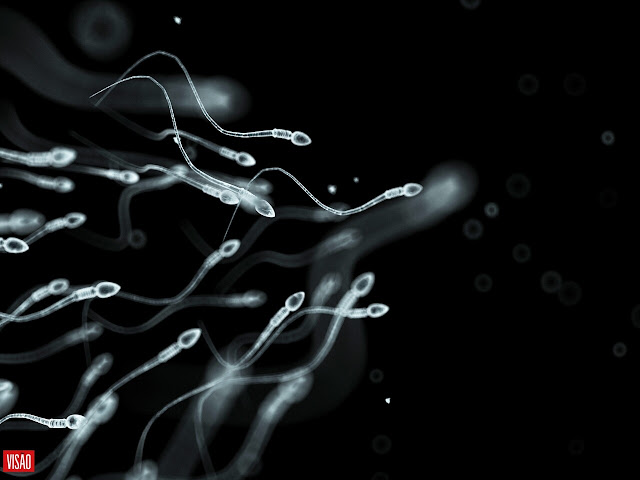 Imagem de espermatozoides.