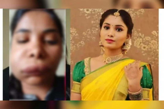 After a botched root canal procedure, an Indian actress's face becomes unrecognizable