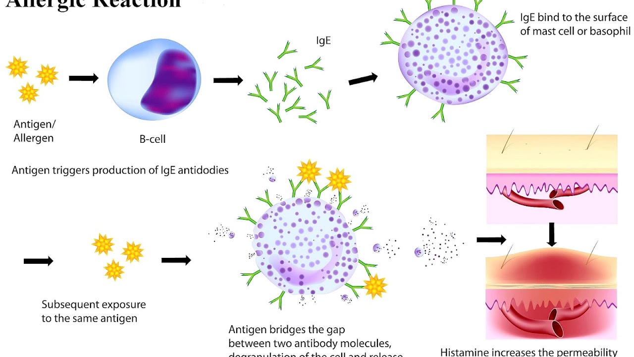 Oral allergy syndrome