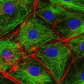 Cytoskeleton