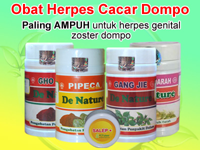 Obat Mujarab Penyakit Dompo Herpes