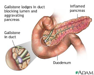 Inflamed Pancreas