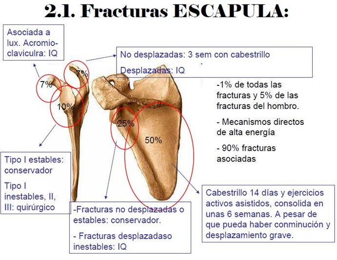 fractura ecapula